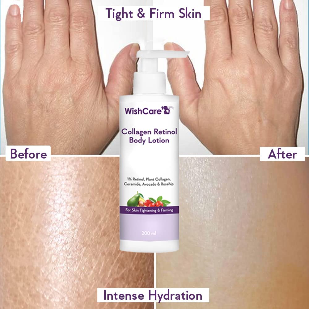 W'ishCare Collagen 1% Retinol Body Lotion for Skin Tightening & Firming - Anti-Aging Moisturizer with Niacinamide, Ceramide, Rosehip & Avocado Oil - Hydrating & Nourishing Cream for Men & Women - 6.76 Fl Oz - Perfect for Daily Skincare Routine & Post-Shower Use