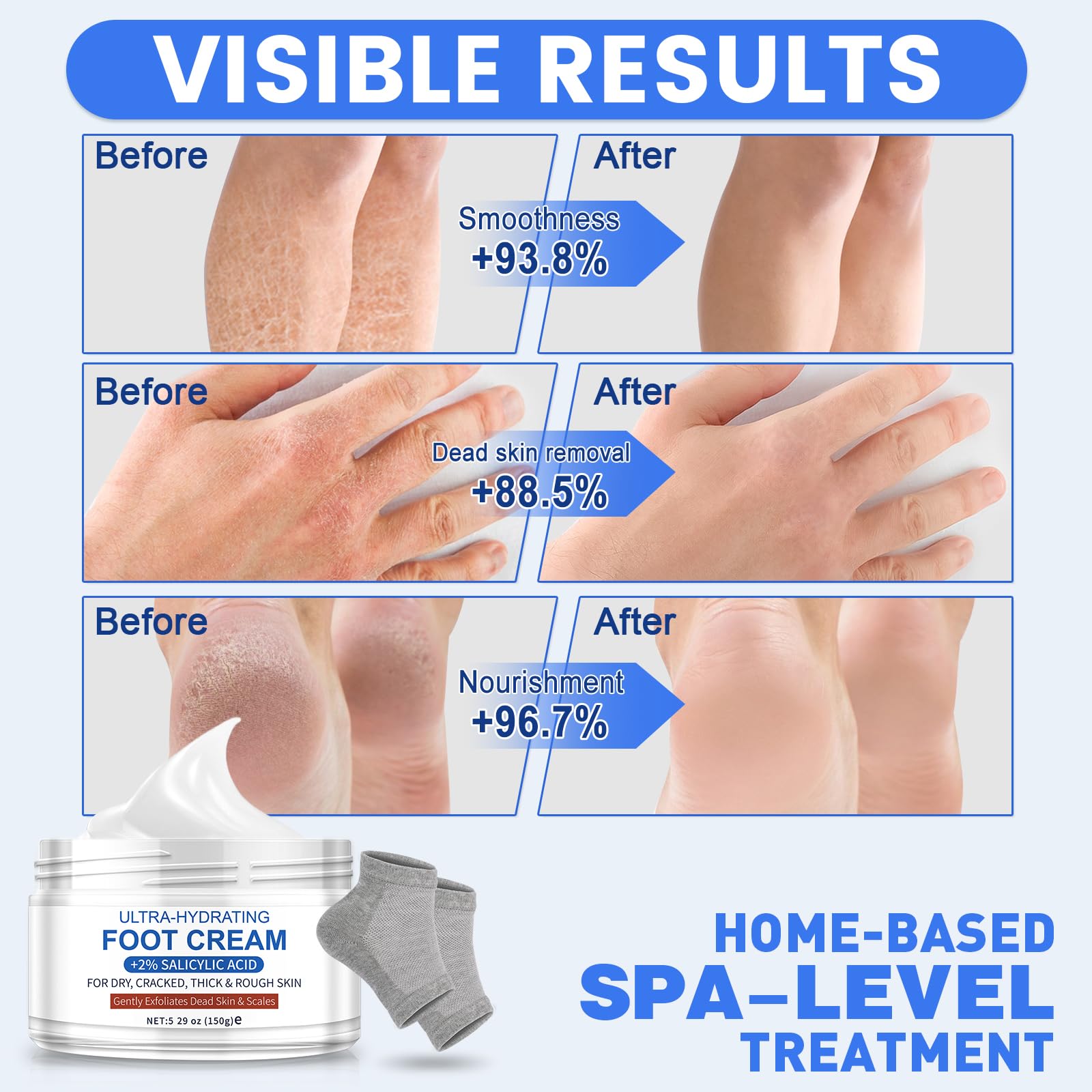Best 40.67% Urea Foot Cream for Dry Cracked Heels - Ultra Hydrating Moisturizer Treatment for Feet - 5.29oz/150g - Perfect for Overnight Repair with Moisturizing Socks