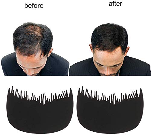 Kabello Hair Loss Concealer Refill Pack - Dark Brown Hair Fibers with Hairline Comb (12g) | Instant Coverage for Thinning Hair & Bald Spots | Perfect for Daily Use, Work, and Social Events