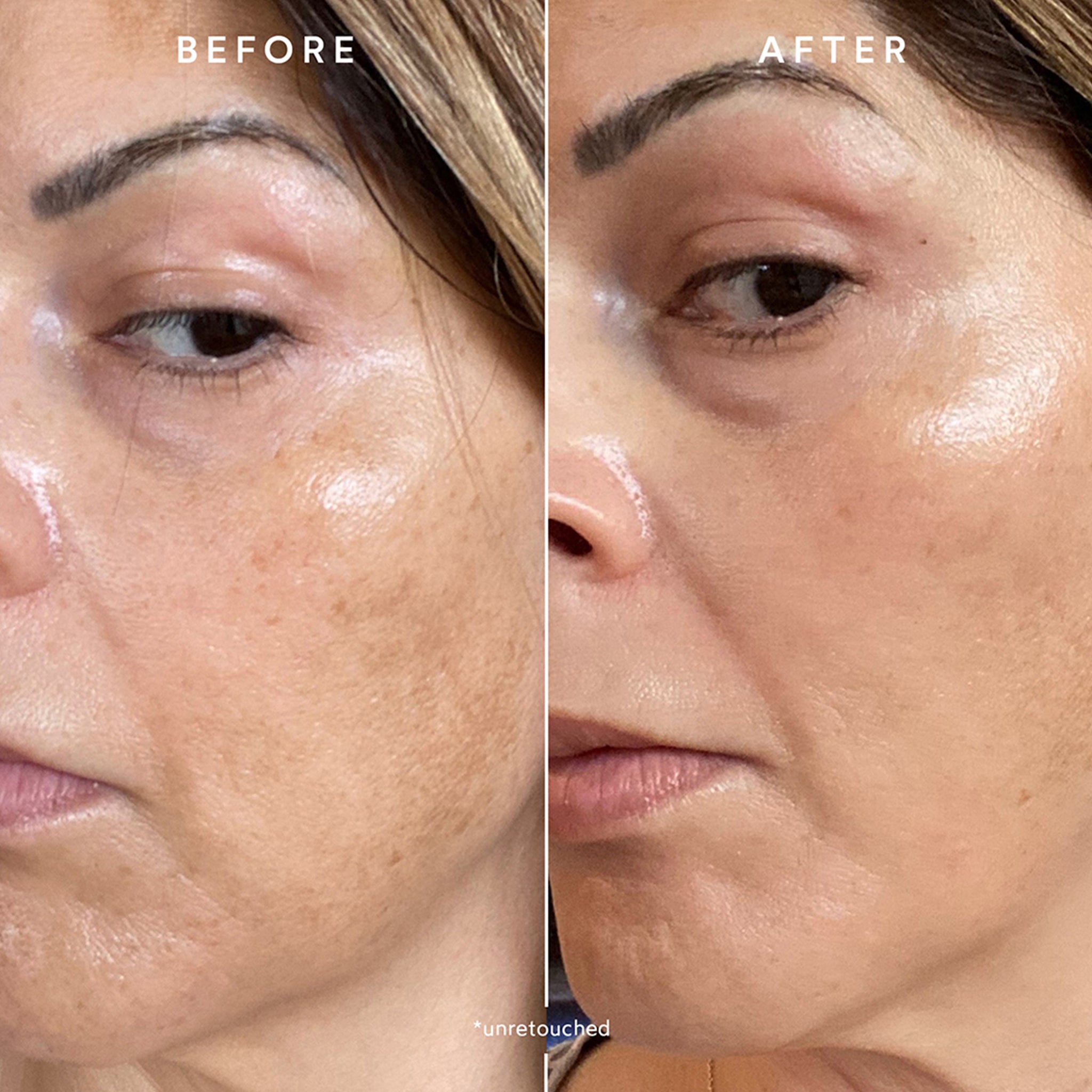 Phyto Retinol Vitamin A Booster Serum for Anti-Aging & Wrinkle Reduction | Natural Skincare Treatment for Face & Neck | Perfect for Night Routine & Dry Skin Care
