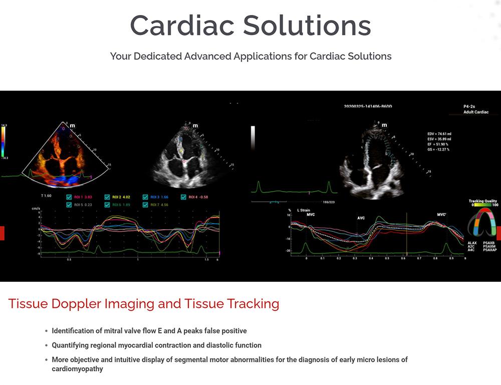 Mindray MX7 Portable Ultrasound Machine - High-Quality Diagnostic Imaging for Medical Professionals | Perfect for Clinics, Hospitals & Emergency Care