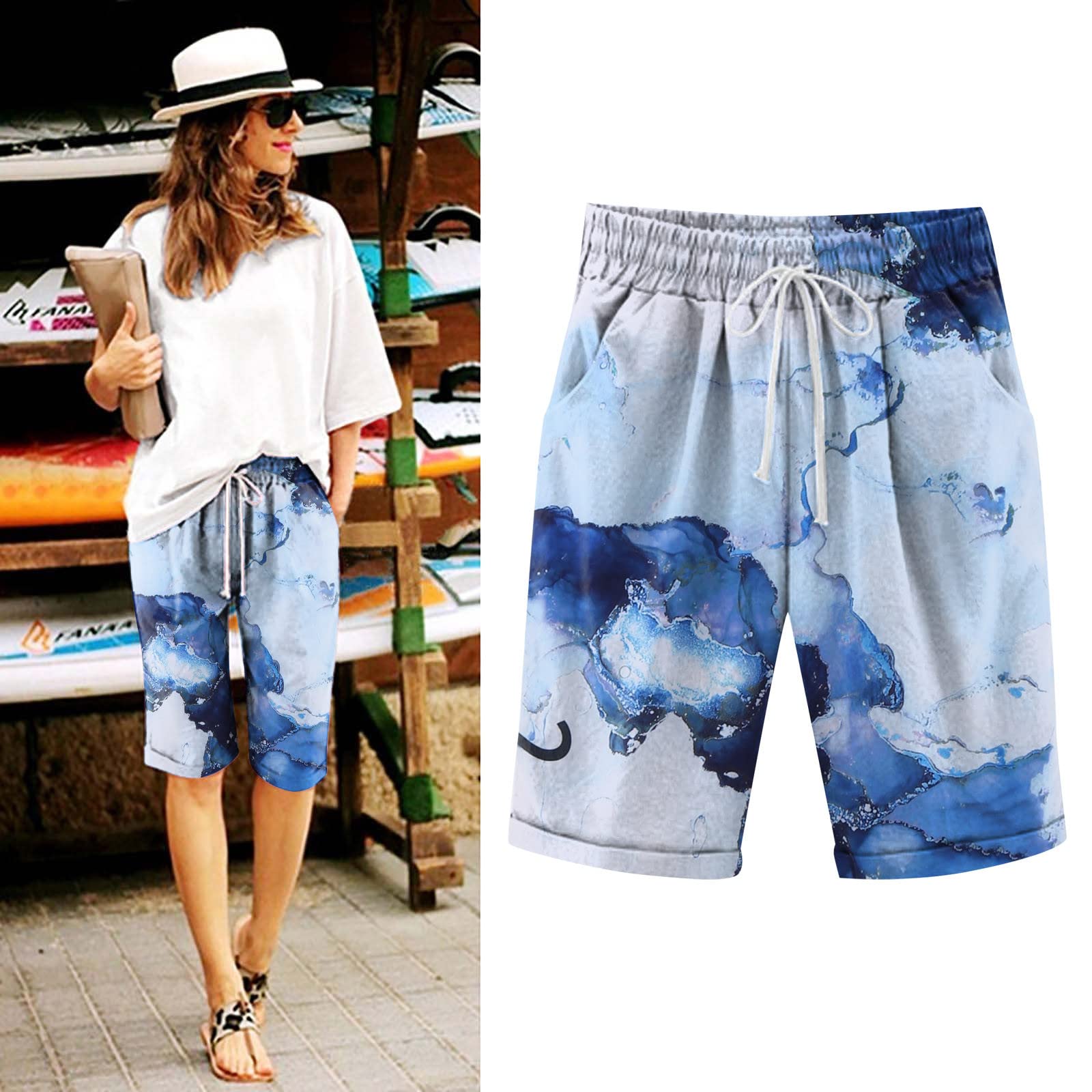 Trendy Women's Bermuda Shorts - Elastic Waist & Knee-Length for Summer Outings