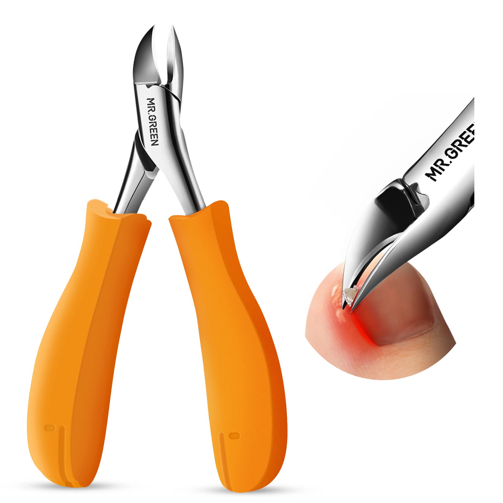 MR.GREEN Professional Nail Clippers Set - Anti-Splash Toenail Cutters for Thick & Ingrown Nails, Manicure & Pedicure Tools with Ergonomic Orange Handle - Perfect for Home Grooming, Travel & Salon Use