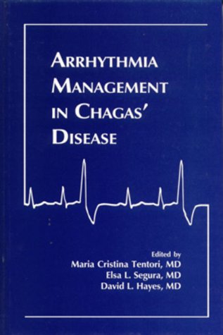 Best Arrhythmia Management Solutions for Chagas Disease - Cardiac Care & Treatment Options for Heart Health