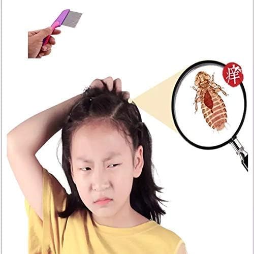 AlexVyan Stainless Steel Long Handle Lice Comb for Head Lice & Nit Removal - Durable Lice Treatment Comb for Men, Women & Kids (Pack of 2) - Perfect for Home, School & Travel Use
