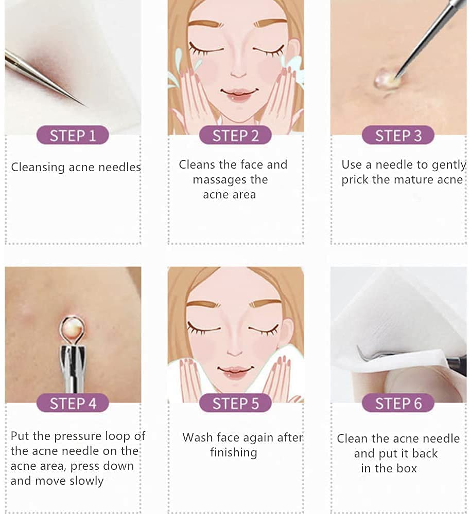 Aadav Beauty Blackhead & Whitehead Removal Tool Kit - Stainless Steel Acne Needles, Double-Sided Pimple Popper & Spot Squeezer - Perfect for Facial Care & Blemish Treatment at Home