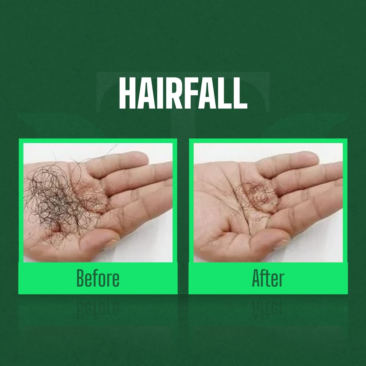 Vikash Thailas Ayurvedic Herbal Hair Oil - 100ml for Hair Growth, Dandruff & Scalp Care | Natural Treatment for Dry, Damaged Hair | Daily Nourishment & Shine