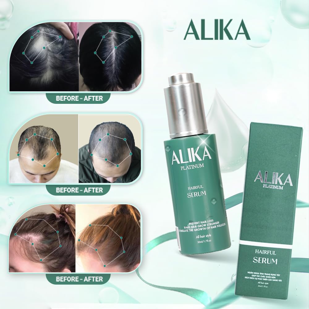 ALIKA 3 Hair Growth Serum for Women & Men - Scalp Treatment for Hair Loss & Thinning - Natural Formula for Dry, Oily & Normal Scalp - Promotes Thicker, Longer & Healthier Hair (50ml) - Perfect for Daily Use at Home, Salon Treatments & Travel
