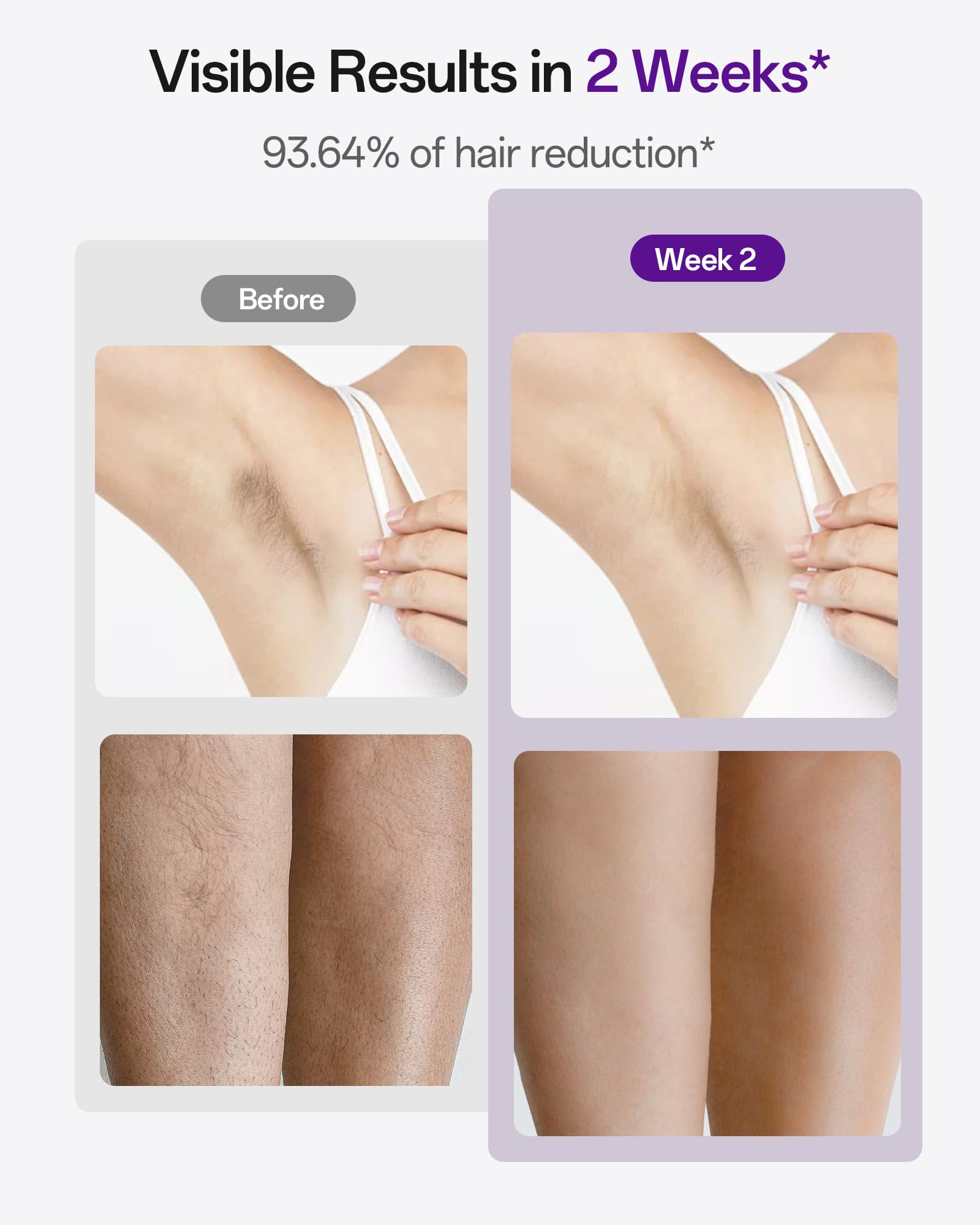 Painless IPL Laser Hair Removal Device with 40°F Sapphire Ice Cooling for Women & Men - Permanent At-Home Hair Removal for Face, Armpits, Bikini & Body | Salon-Quality Results for Smooth Skin at Home