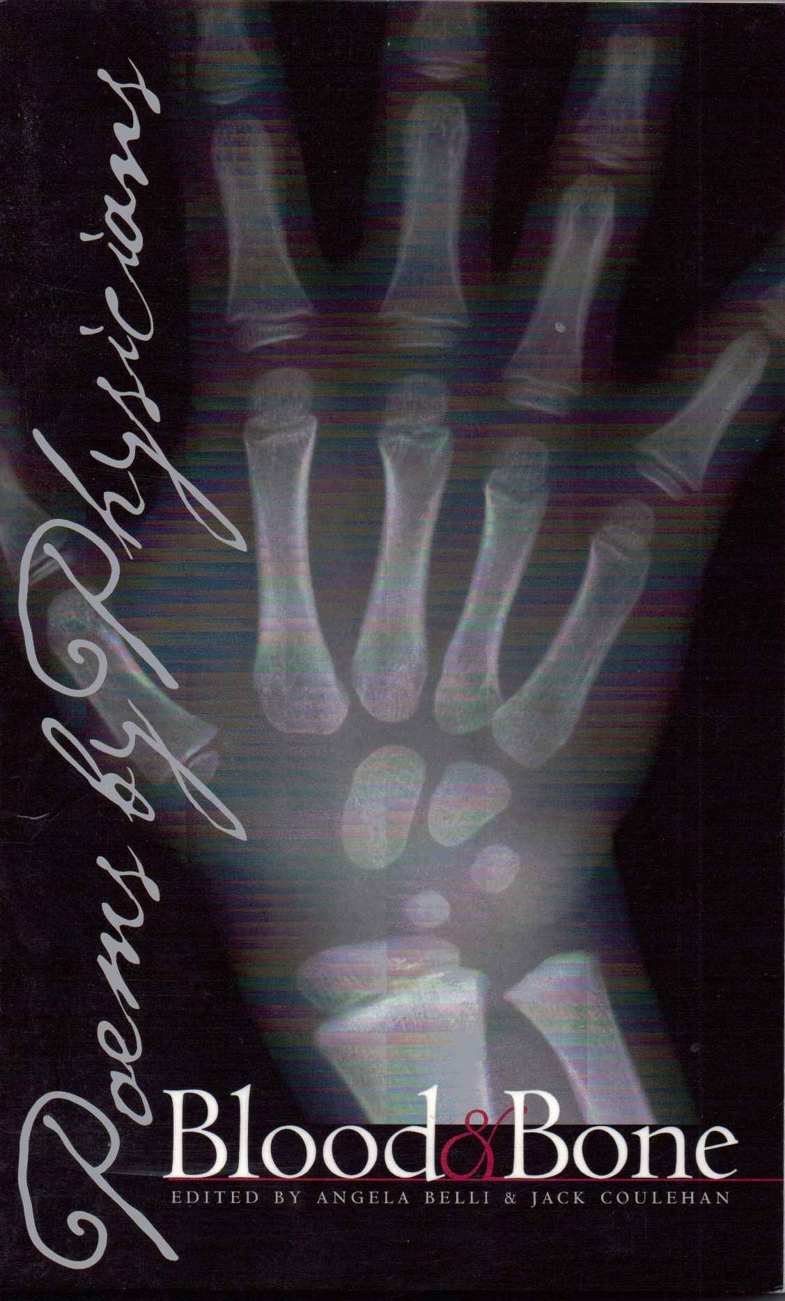 Blood and Bone: Poems by Physicians - A Collection of Medical Poetry for Reflection & Healing | Perfect for Doctors, Nurses & Healthcare Professionals