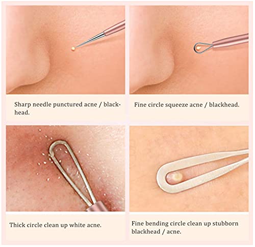 Professional Blackhead Remover Kit - Stainless Steel Acne & Blemish Extractor Tool for Face & Nose - Whitehead & Blackhead Popping Tools with Metal Case - Perfect for Home Skincare & Spa Treatments
