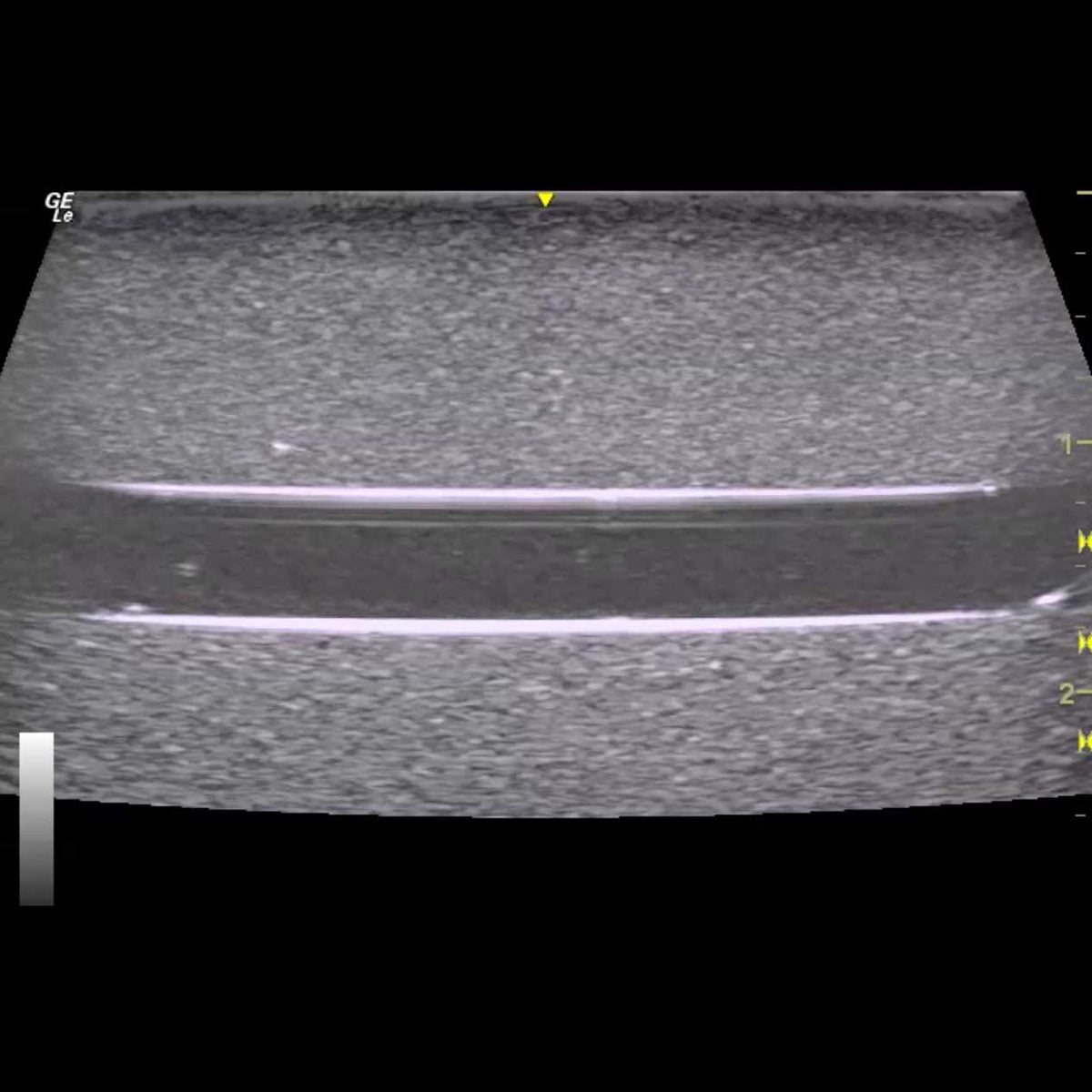 HM2.0 Remoldable 2-Vessel Ultrasound Training Model - Perfect for Medical Students & Sonography Practice (Arterial & Venous Vessel Simulation)