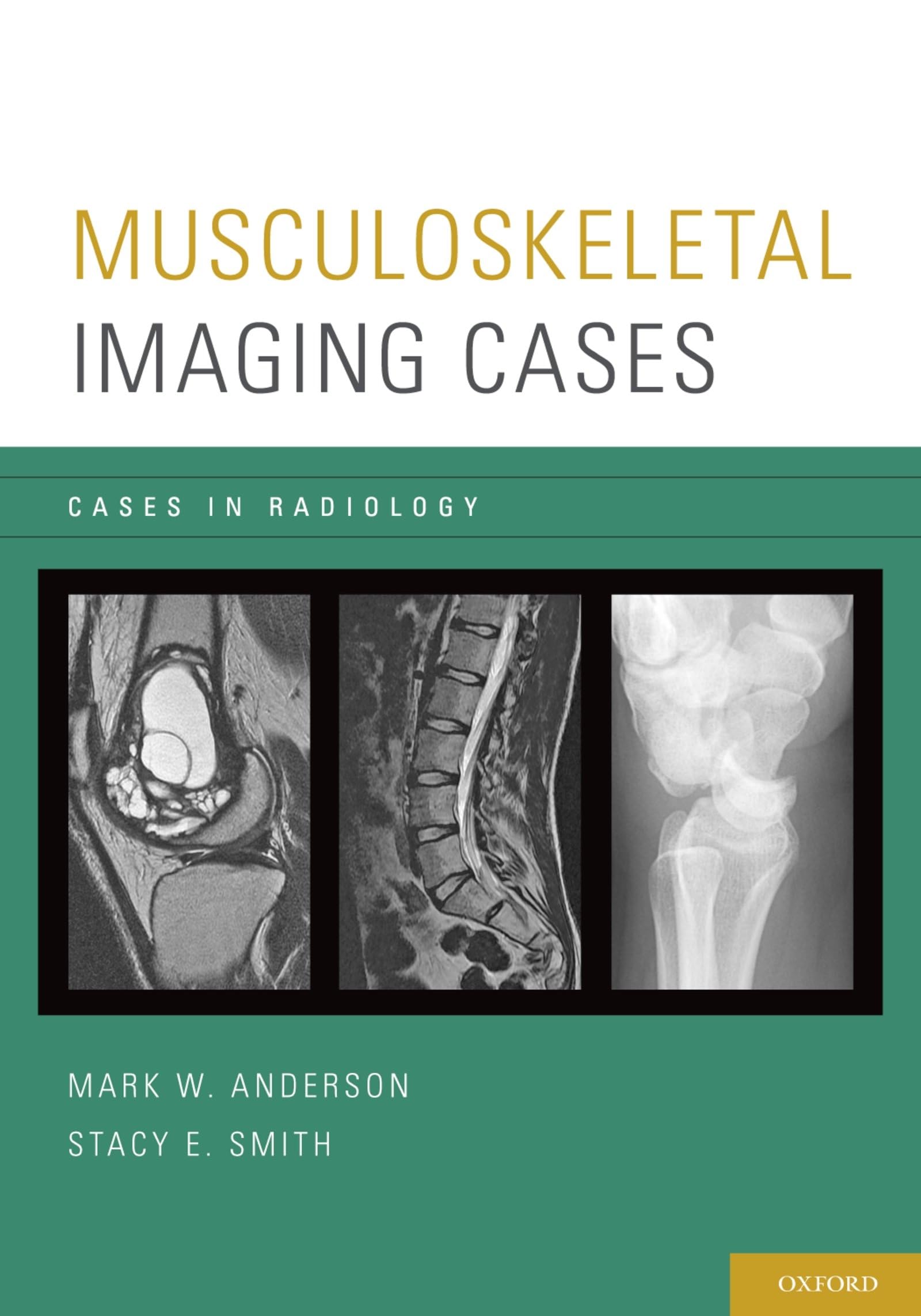 Musculoskeletal Imaging Cases Book - Radiology Case Studies for Medical Students & Professionals | Diagnostic Practice & Learning Resource