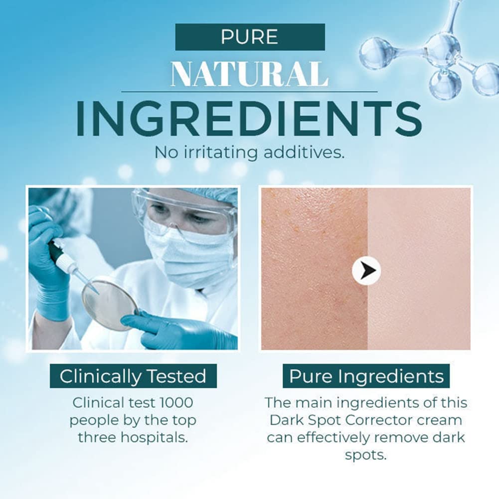 Dark Spot Corrector for Face & Body - Natural Pigmentation Treatment with Cruelty-Free Ingredients | Brightening Serum for Women (30g) | Perfect for Daily Skincare Routine & Hyperpigmentation Care