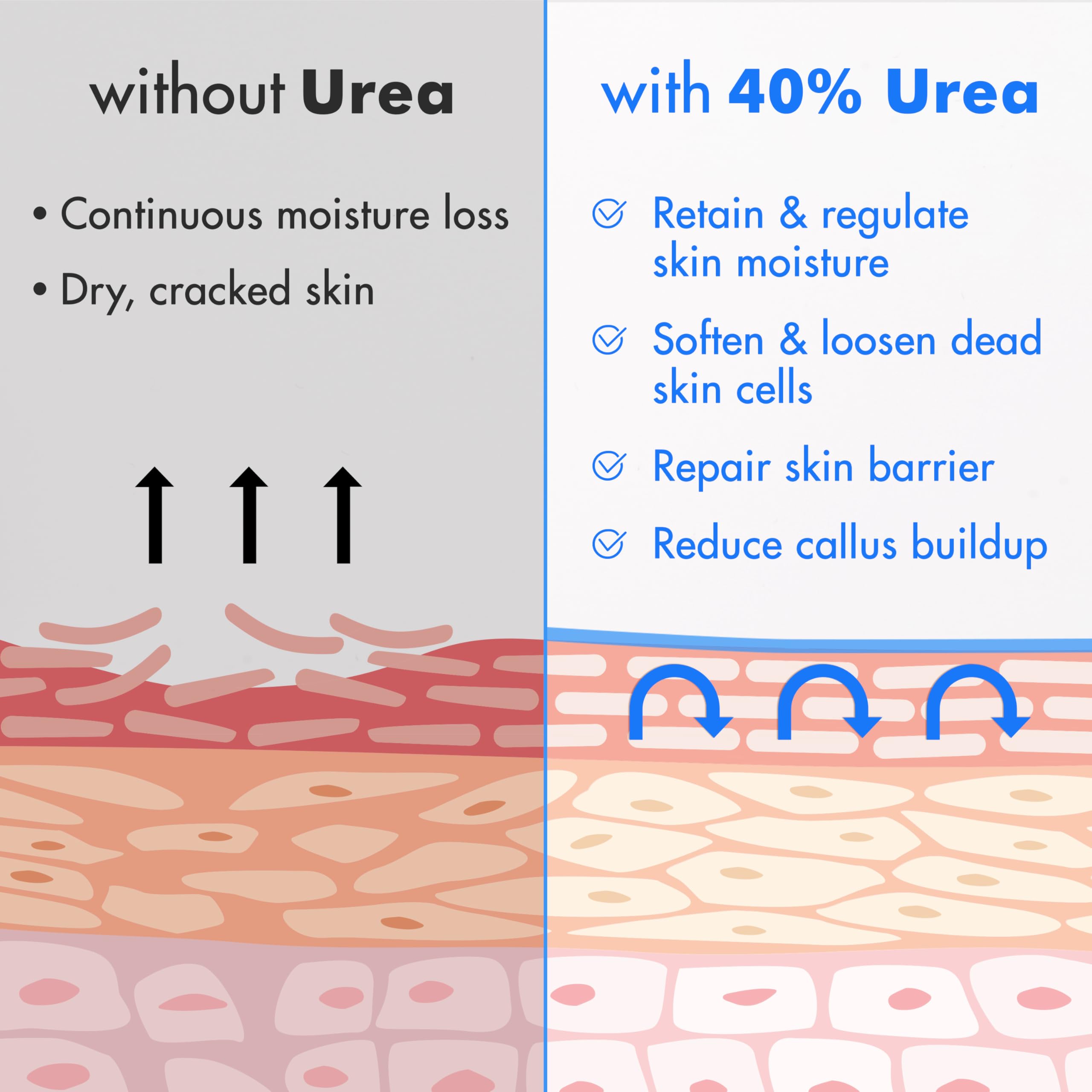 Ebanel 40% Urea Cream with 2% Salicylic Acid - Intensive Foot Repair for Dry Cracked Heels, Callus Remover & Skin Softener - Keratolytic Treatment for Hands, Knees & Elbows - Perfect for Pedicures & Cracked Skin Relief