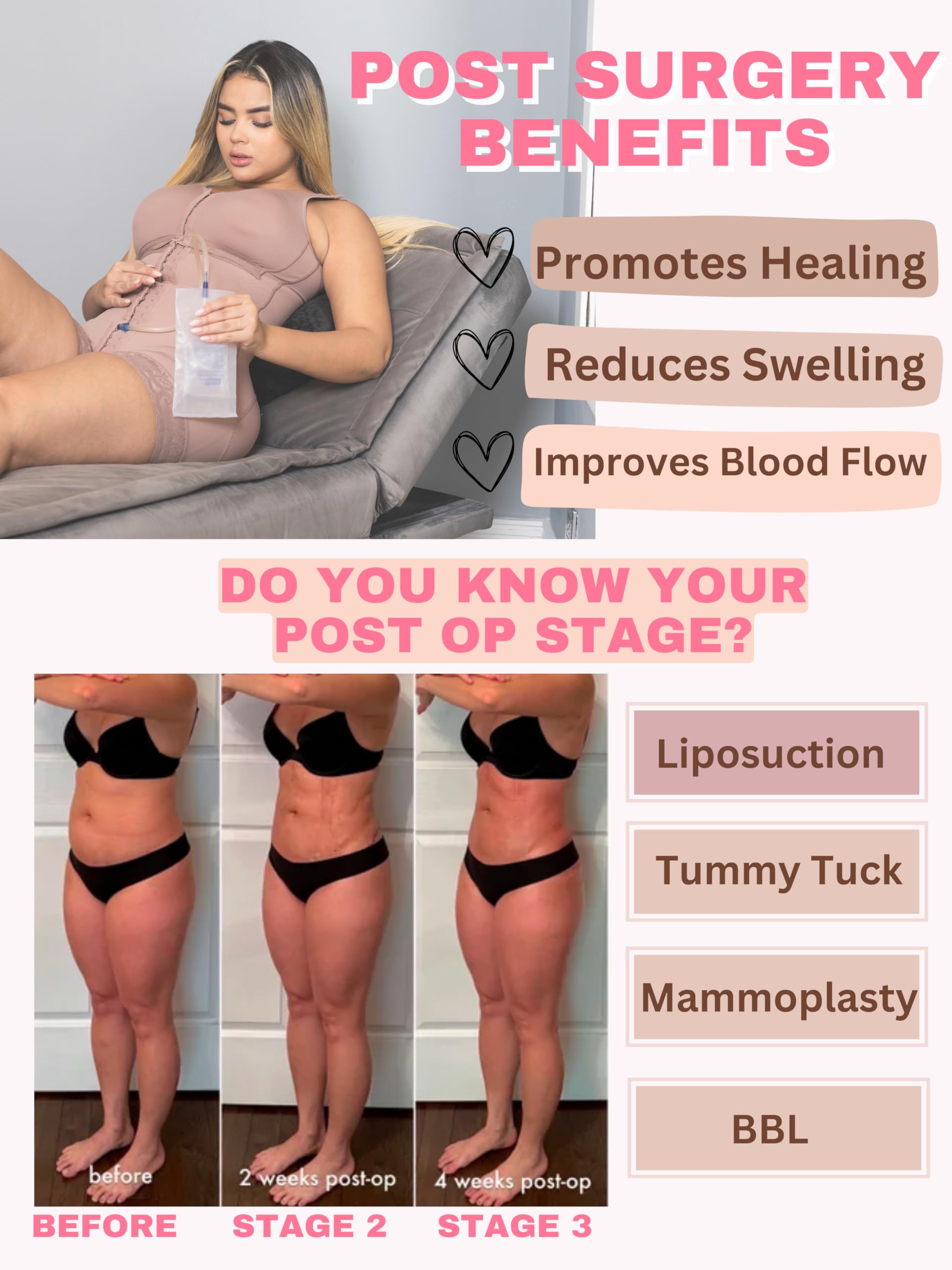 Sonryse S010 Colombian Post-Surgery Compression Garment for Women - Stage 1 BBL, Tummy Tuck & Lipo Recovery - Breathable Waist Trainer & Body Shaper for Postpartum, Weight Loss & Everyday Wear