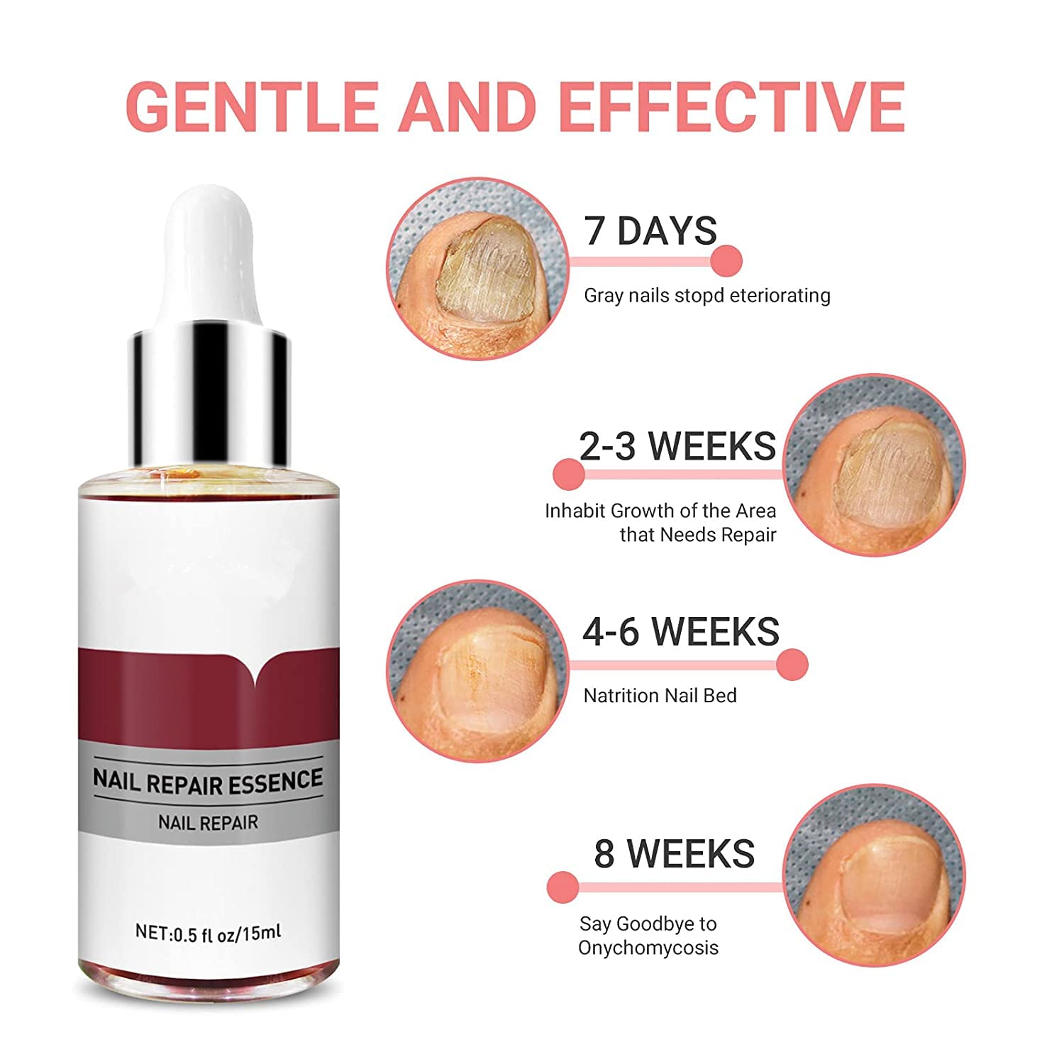 Nail Repair Essence for Stronger Nails - 0.5fl.oz Fingernail & Toenail Treatment - Perfect for Damaged, Brittle Nails and Nail Care Routine