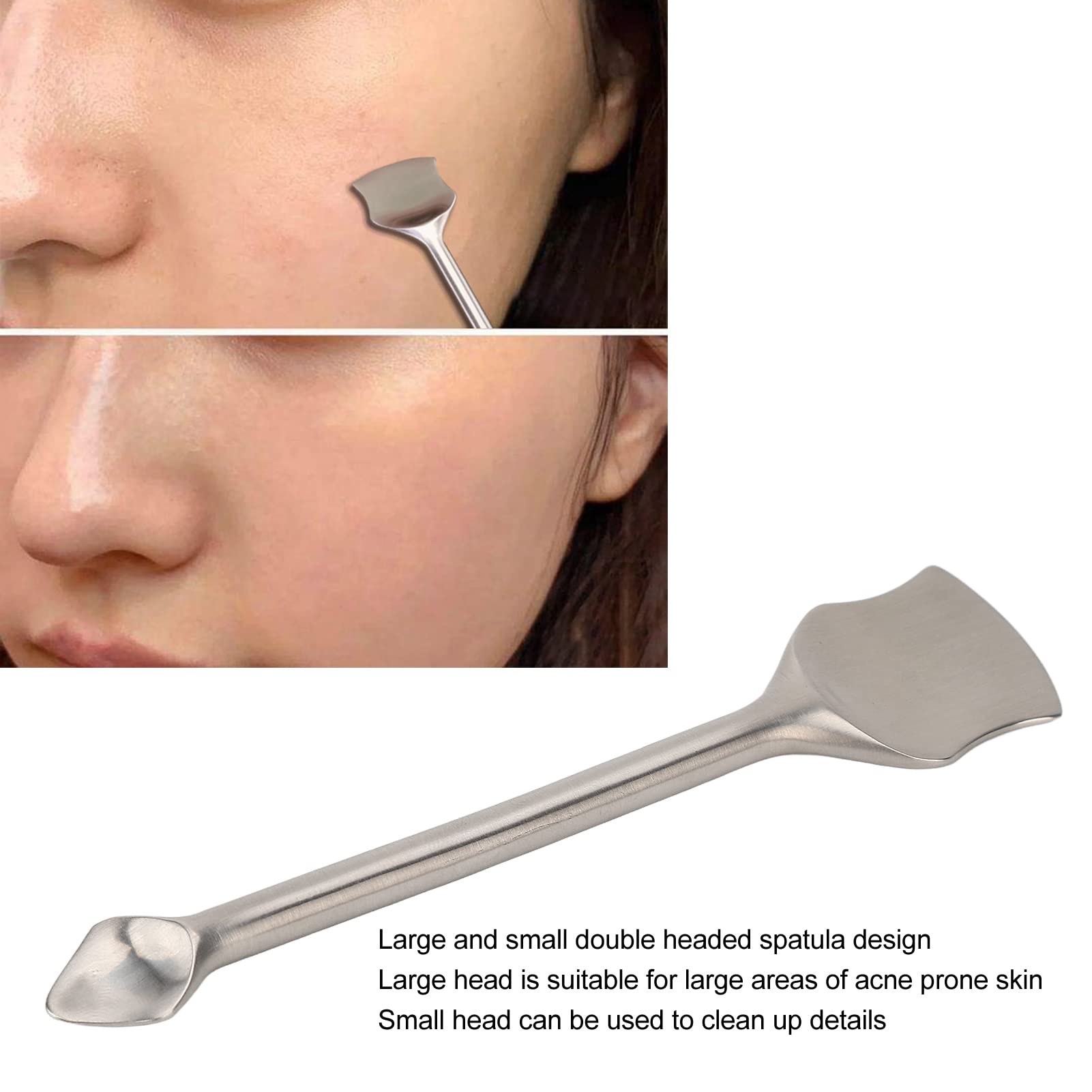 Stainless Steel Blackhead & Pore Cleaner Tool - Professional Acne Extractor for Women & Teens | Gentle Skin Care for Face, Nose & Body | Perfect for Home Spa & Daily Skincare Routine