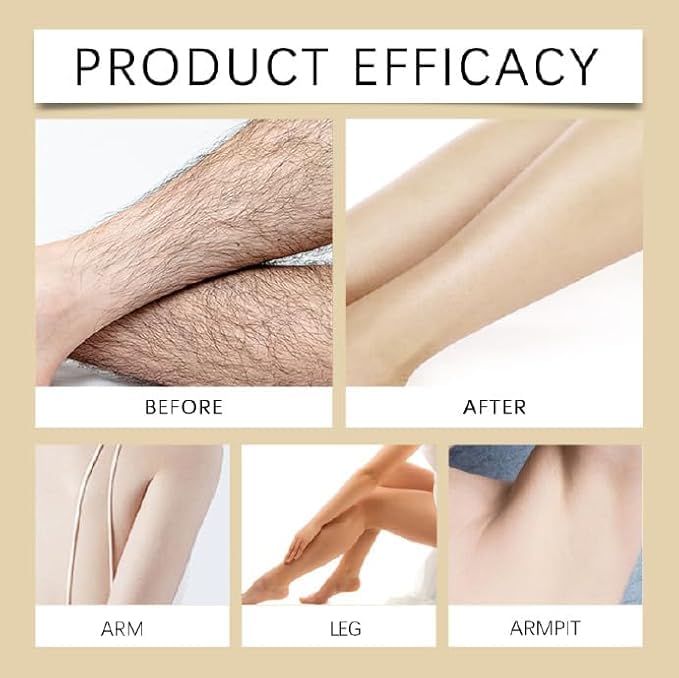 Rotundu Oil for Hair Removal - Natural & Effective Hair Removal Solution for Smooth Skin | Perfect for At-Home Waxing, DIY Hair Removal & Skin Care