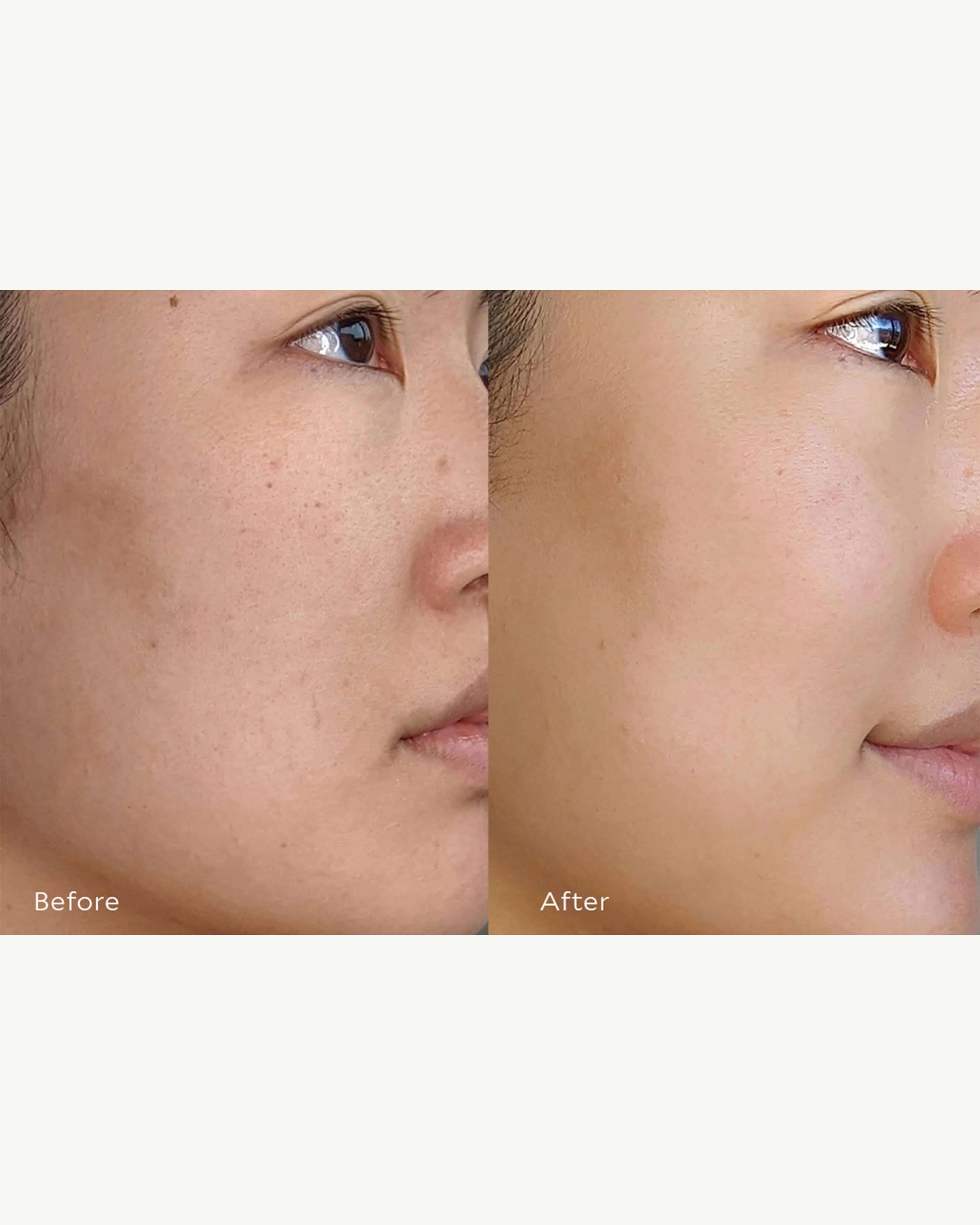Best Resurfacing Serum for Glowing Skin - Anti-Aging & Brightening Face Treatment - Perfect for Night Routine & Skincare Regimen