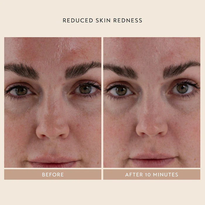 Shani Darden Signature Facial Mask with Squalane - Super Nutritious Hydrating Face Mask for Dry Skin | At-Home Spa Treatment & Self-Care Routine