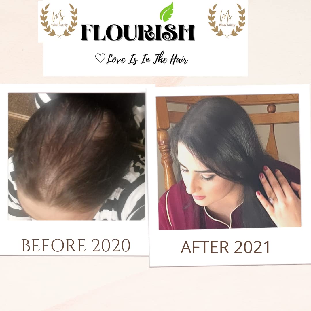 FLOURIS Hair Growth Oil - Natural Scalp Treatment for Thicker, Longer Hair | Best for Hair Loss Prevention & Healthy Hair Care