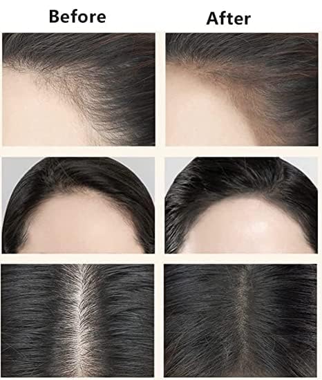Glowhouse Shade Hairline Powder - Waterproof Hair Root Concealer & Quick Touch-Up Stick with Sponge Pen for Natural Hairline Shadow - Perfect for Daily Use, Travel, and Covering Gray Roots