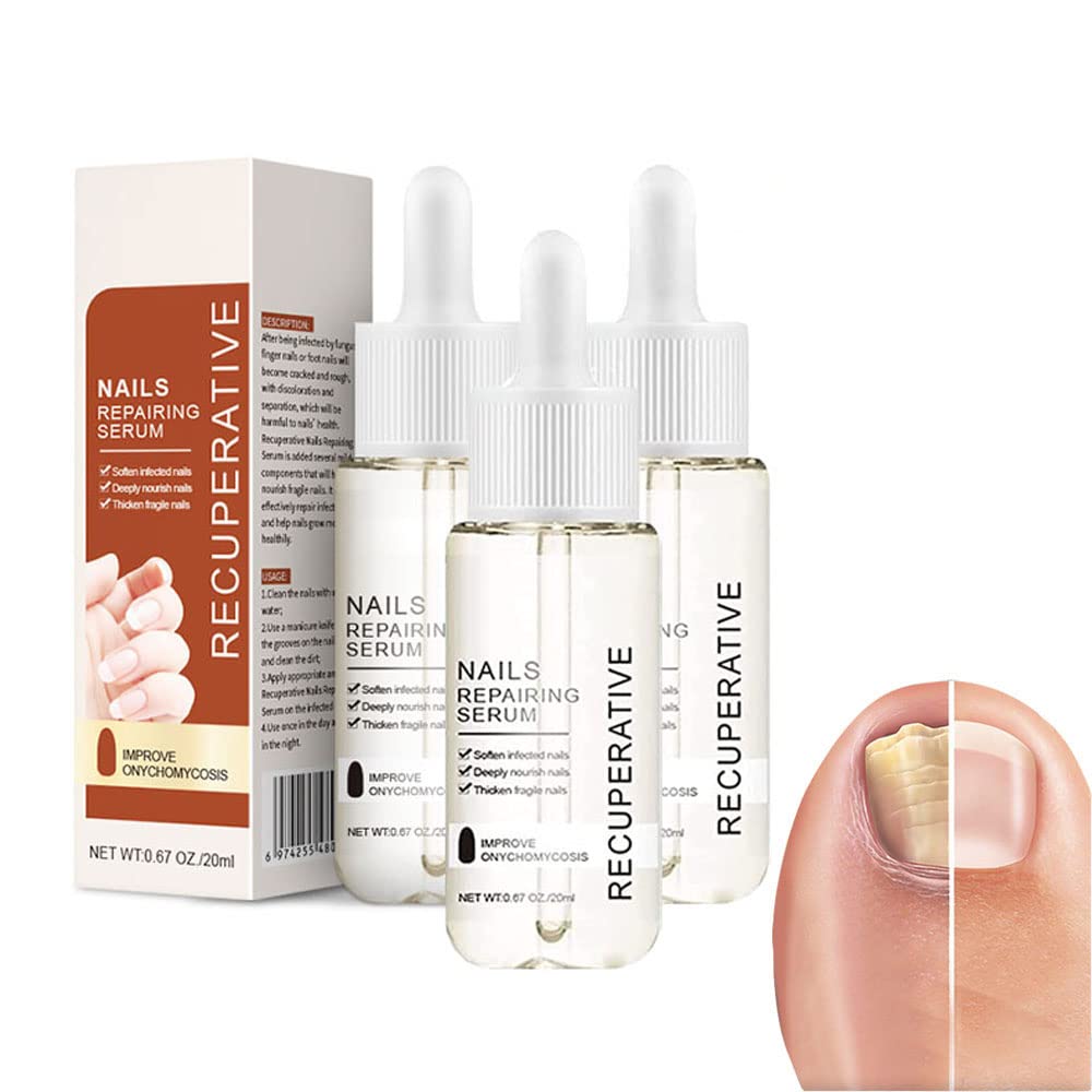 7 Days Fast Nail Growth & Strengthening Serum - Natural Nail Treatment for Stronger, Healthier Nails - 3 Pack for Daily Care & Manicure Prep - Perfect for Weak, Brittle Nails & Nail Art Enthusiasts