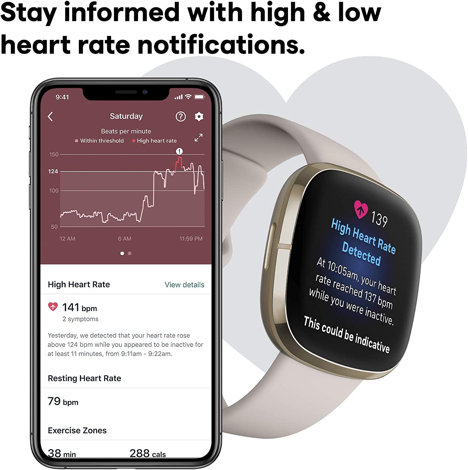 Fitbit Sense Advanced Health & Fitness Smartwatch with ECG, Stress Sensor, 24/7 Heart Rate & SpO2 Monitoring - Renewed Like New (White/Gold) | Perfect for Workouts, Sleep Tracking & Daily Activity Monitoring