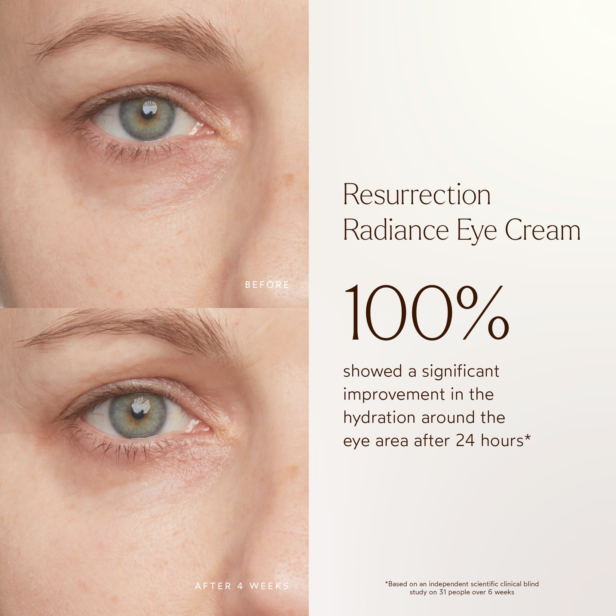 Resurrection Radiance Anti-Aging Eye Cream for Dark Circles & Wrinkles - Hydrating & Firming Under Eye Treatment for Women & Men - Perfect for Night Routine & Travel Skincare