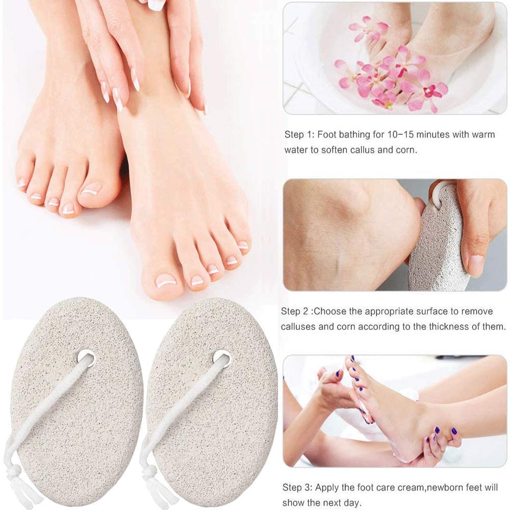 Premium Oval Pumice Stone for Dead Skin Removal - Callus & Cracked Heel Exfoliator for Men & Women - Perfect for Pedicures, Foot Care & At-Home Spa Treatments