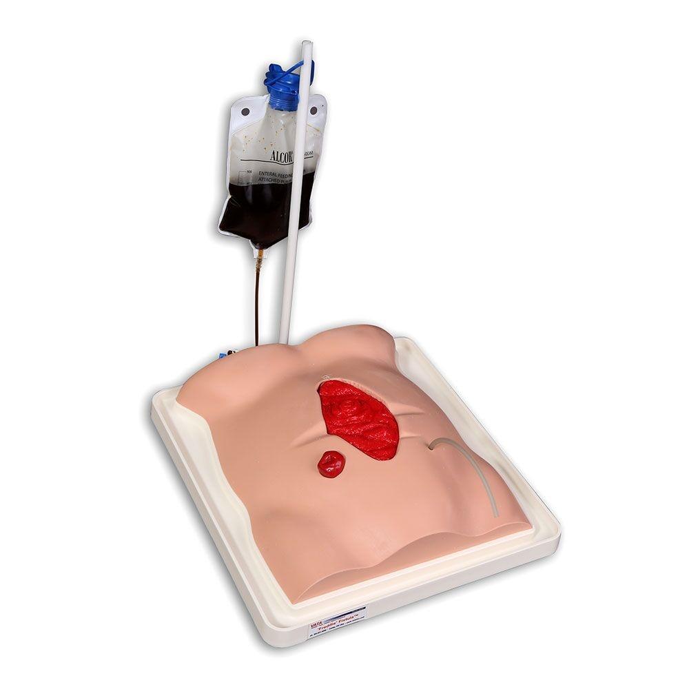 Freddie Fistula™ Hemodialysis Skills Trainer Kit with Carrying Case - Perfect for Nursing Students & Dialysis Training Practice