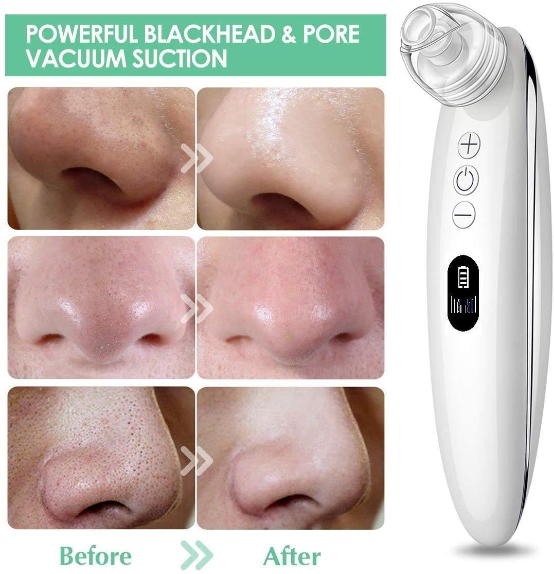 Electric Blackhead Remover Vacuum with LED Display - Powerful Facial Pore Cleaner for Blackheads, Whiteheads & Acne - Skin Care Tool for Men & Women - Perfect for Daily Facial Cleansing & Spa Treatments