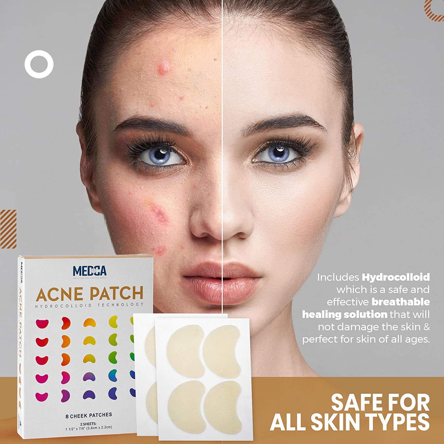 MEDca Acne Pimple Patch - 16 Count Hydrocolloid Bandages for Cheek & Face - Absorbing Spot Treatment for Pimples & Blackheads - Clear Skin Care for Teens & Adults - Perfect for Overnight Use & Daily Breakout Control