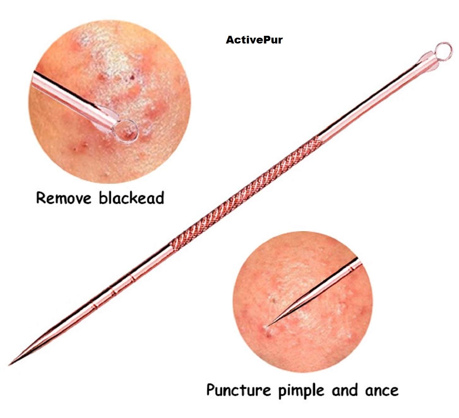 Professional Blackhead & Pimple Remover Kit - 4-Piece Acne Extractor Tool for Whitehead & Comedone Removal | Safe for Face, Nose & Skin | Includes Travel Case | Perfect for Home Skincare & Spa Treatments
