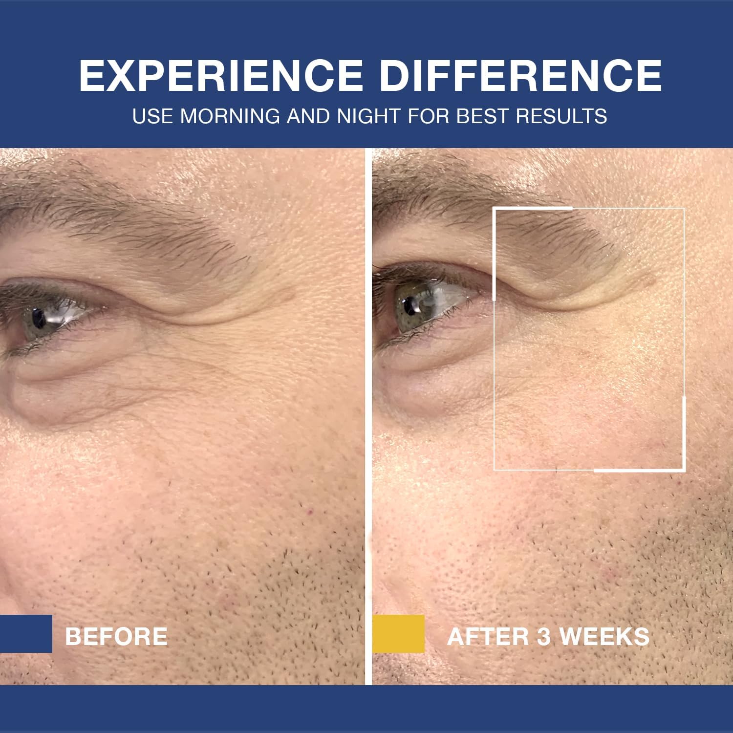6-in-1 Anti-Aging Face Cream for Men - Moisturizer, Wrinkle & Eye Bags Treatment, 1.7 oz | Daily Hydration & Skin Repair for Men's Skincare Routine