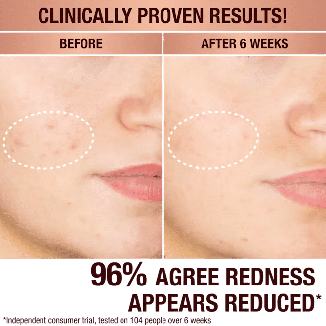 Dark Spot Correcting Radiance Recovery Serum for Face - Brightening & Even Skin Tone Treatment - Perfect for Daily Skincare Routine & Hyperpigmentation Care