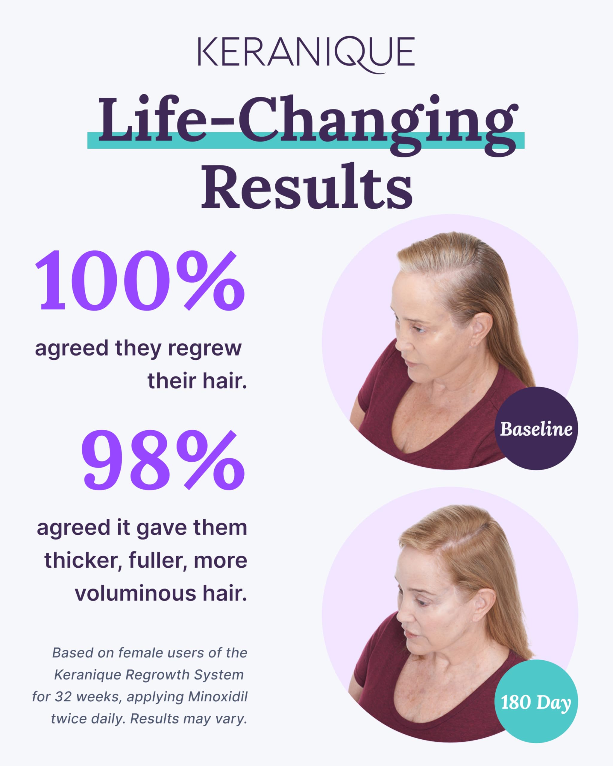 Keranique Hair Growth Treatment for Women - Minoxidil Regrowth System with Hydrating Shampoo & Conditioner + Volumizing Spray | Effective Hair Loss Solution for Thinning Hair | Perfect for Daily Use & Salon-Quality Results at Home