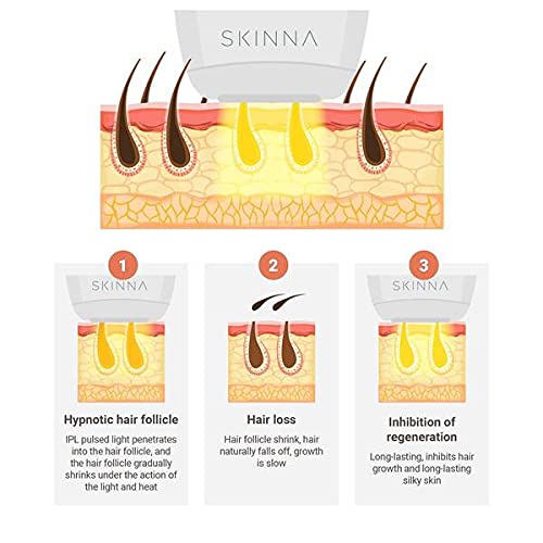 Skinna IPL Laser Hair Removal System for Women & Men - Permanent Painless At-Home Hair Remover for Face, Arms, Legs, Bikini Line & Full Body | Safe & Effective DIY Laser Hair Removal Device | Perfect for Smooth Skin Before Beach Vacations, Date Nights & Summer Outfits
