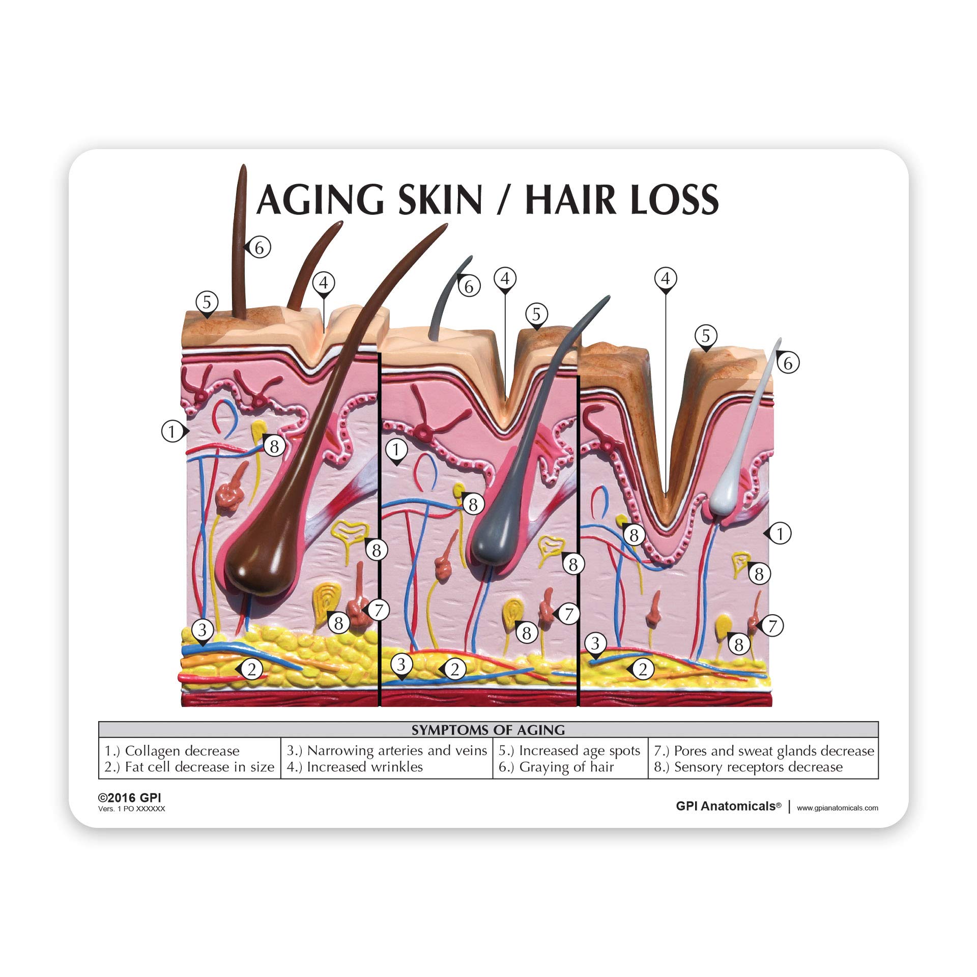 GPI Anatomicals - Aging Skin and Hair Loss Model, Human Anatomy Replica for Medical Education | Shows Aging vs Normal Skin | Ideal for Doctor Offices, Medical Schools & Physiology Learning | Perfect for Dermatology Training & Patient Education