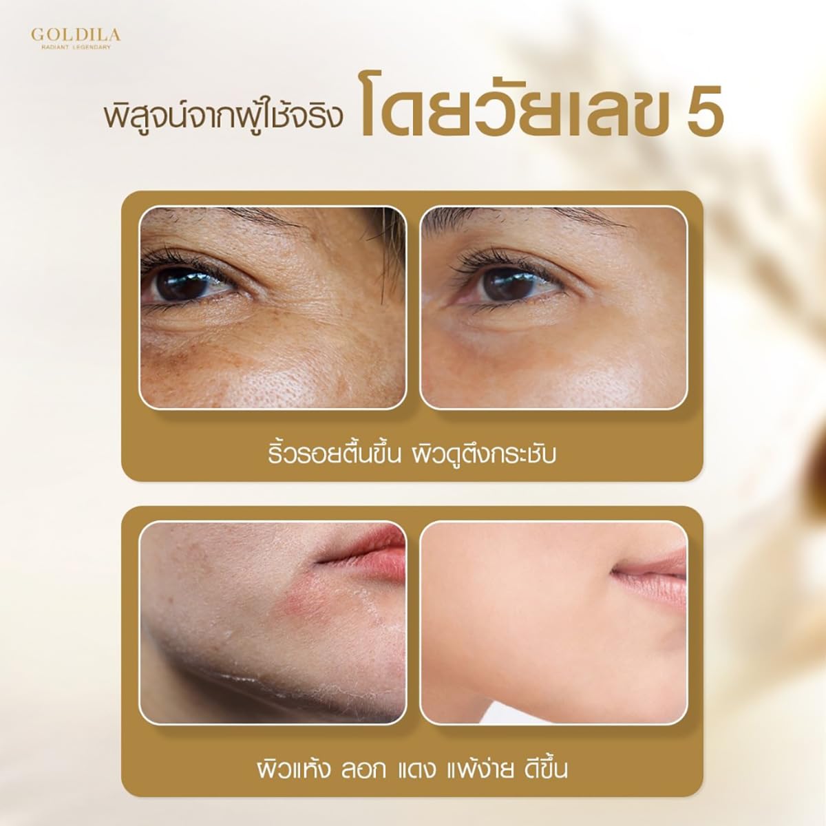 Goldila R R Concentrate Serum 30ml - French Anti-Aging Face Serum for Smooth & Moisturized Skin | 4-Pack Box | Perfect for Daily Skincare Routine & Gift Sets | Free Beauty Gifts Included
