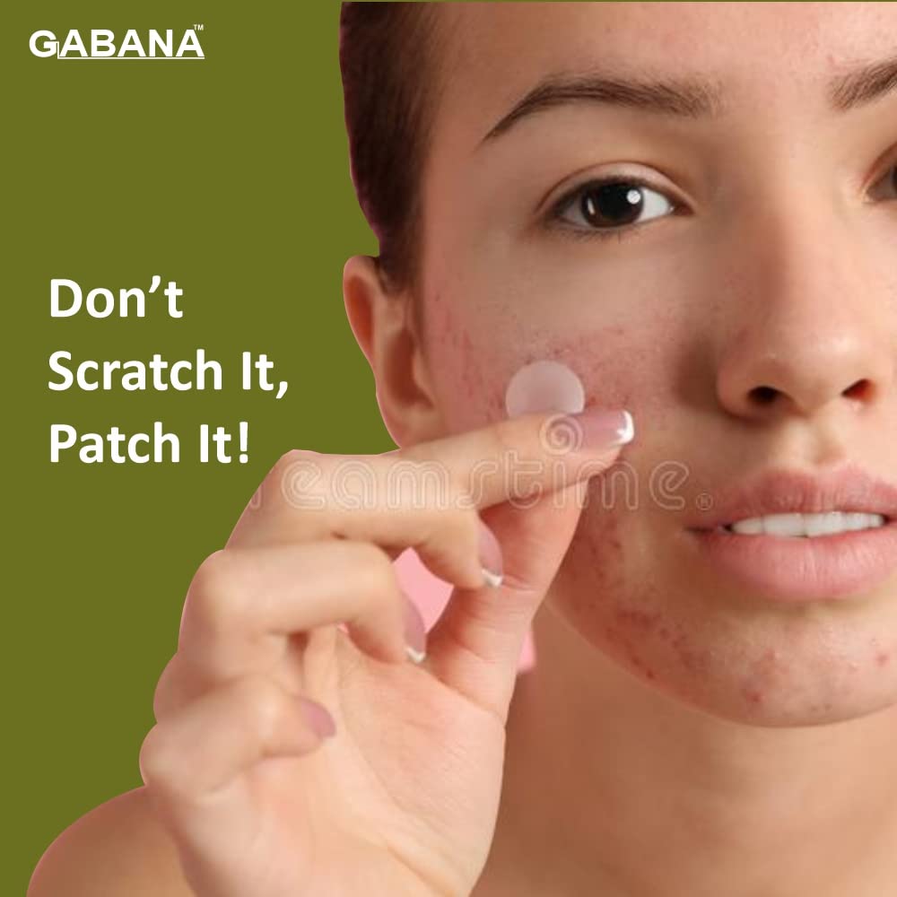 GABANA Acne Pimple Patch for Face - 36 Hydrocolloid Patches for Men & Women | Treats Acne, Dark Spots & Pimple Marks | Suitable for Oily & Dry Skin | Perfect for Overnight Spot Treatment & Daily Skincare Routine