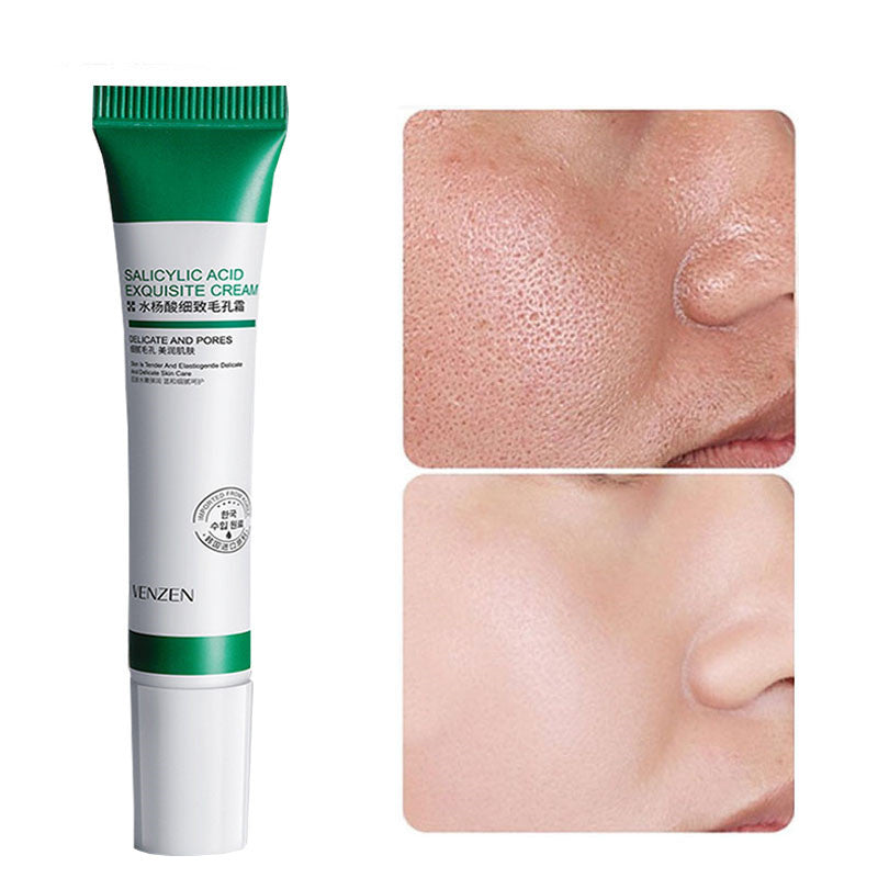 Salicylic Acid Pore Minimizing Cream - Exfoliating Face Moisturizer for Acne Prone Skin | Skin Rejuvenation & Brightening Treatment | Perfect for Daily Skincare Routine & Blemish Control