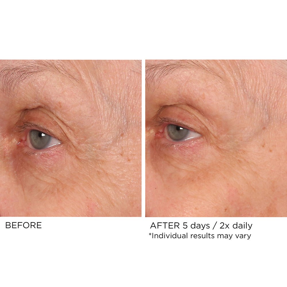 Best Anti-Aging Eye Serum for Wrinkles & Dark Circles - Age Defying Eye Renewal Treatment - Perfect for Night Routine & Daily Skincare