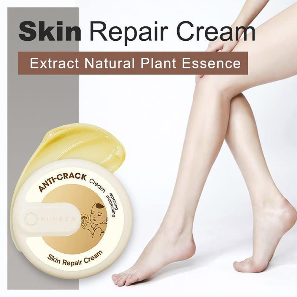 LLYAND Cracked Skin Repair Cream - Intensive Healing for Dry, Cracked Hands & Feet - Anti-Dryness & Crack Prevention - 15g Heel Balm - Perfect for Winter Skin Care & Extreme Dryness Relief