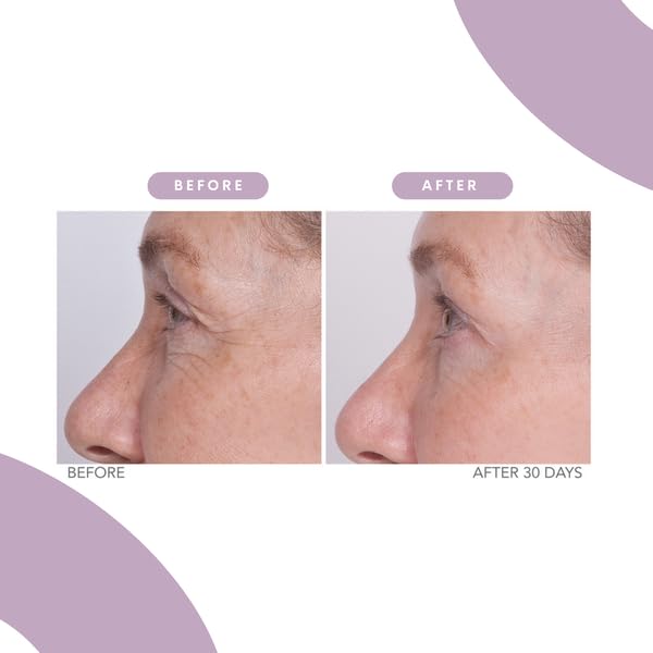 Serious Skincare Reverse Lift Eye Cream with Peptides - Anti-Aging Moisturizer for Wrinkles & Firming - Temporarily Lifts Eyelids & Under Eyes - 1 Fl Oz - Perfect for Day & Night Skincare Routine (Women & Men)