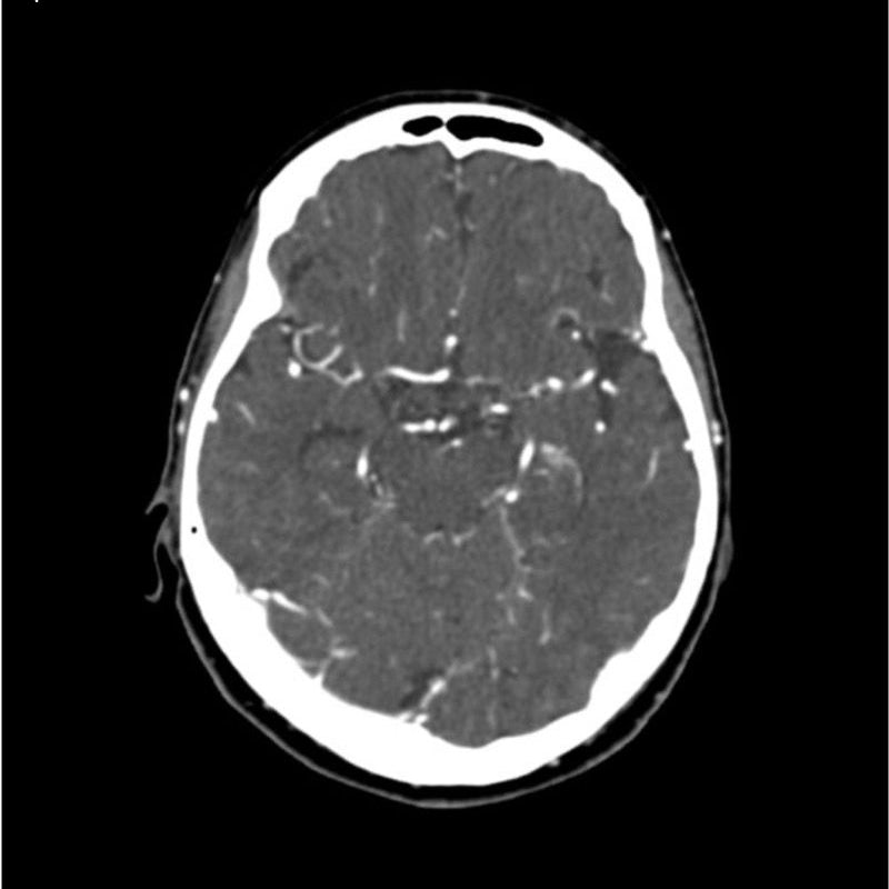 Professional CTA Head and Neck Phantom - High-Quality CT Scan & X-Ray Training Model for Medical Education | Perfect for Radiology Students, Technicians & Clinical Practice