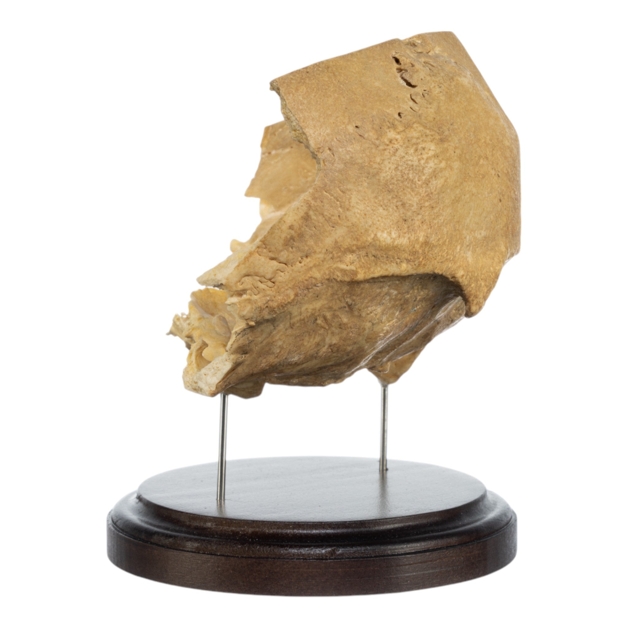 Real Human Partial Skull on Stand - Anatomical Model for Medical Study, Halloween Decor & Gothic Display - Perfect for Doctors, Students & Dark Aesthetic Collectors