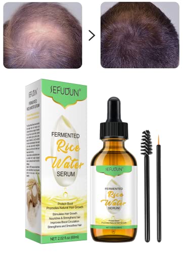 Natural Rice Water Hair Growth Oil for Thin Hair & Hair Loss Treatment - Essential Serum for Damaged Dry Hair - Strengthens & Thickens Hair for Men & Women - Perfect for Daily Scalp Massage & Overnight Hair Repair
