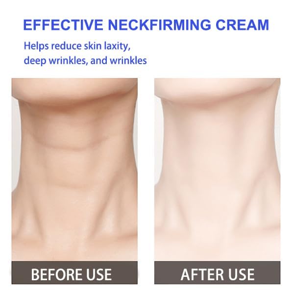2024 Anti-Aging Neck Firming Cream - Tighten & Lift Sagging Skin, Reduce Turkey Neck Wrinkles | Best Neck Cream for Women & Men | Daily Skincare Routine for Youthful Neck & Décolleté